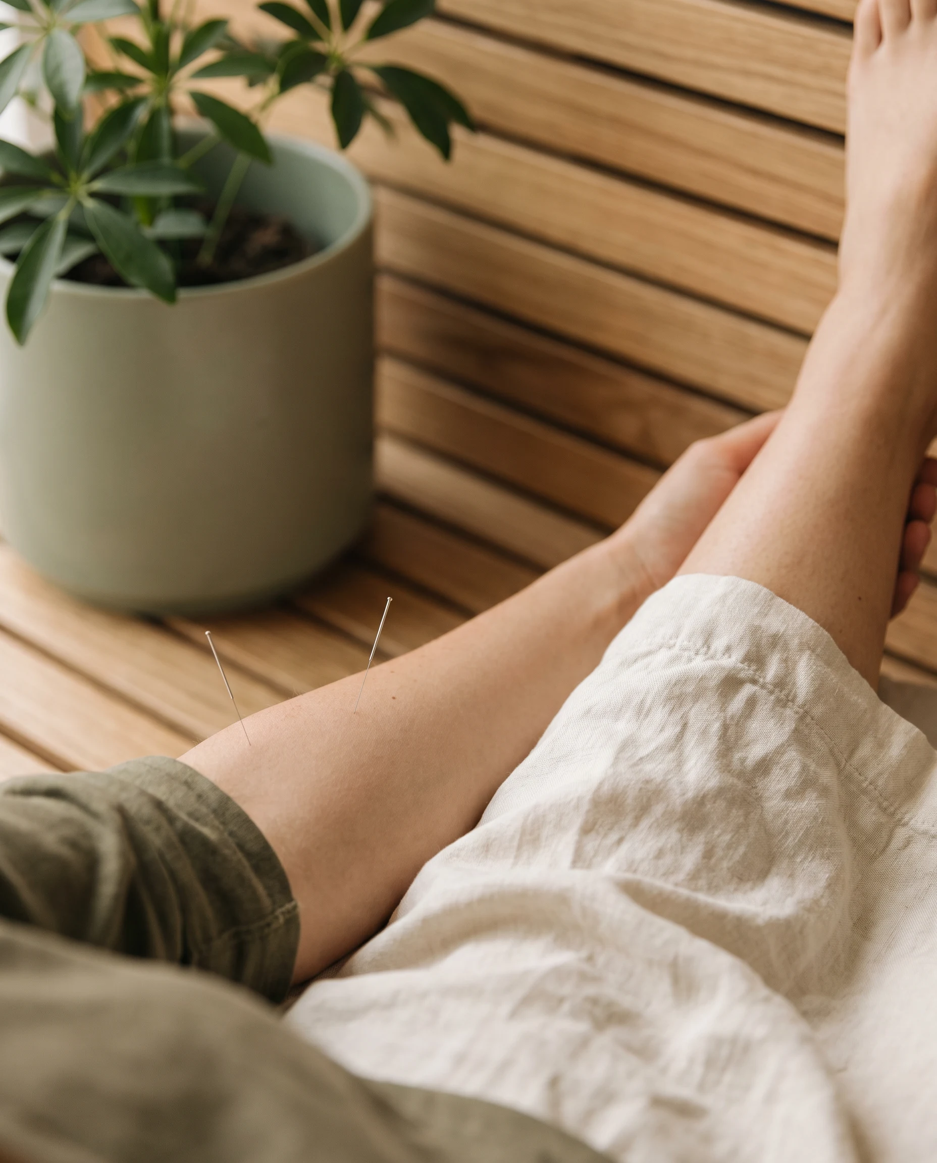 Fine acupuncture needles placed in an anonymous relaxed forearm on natural linen.
