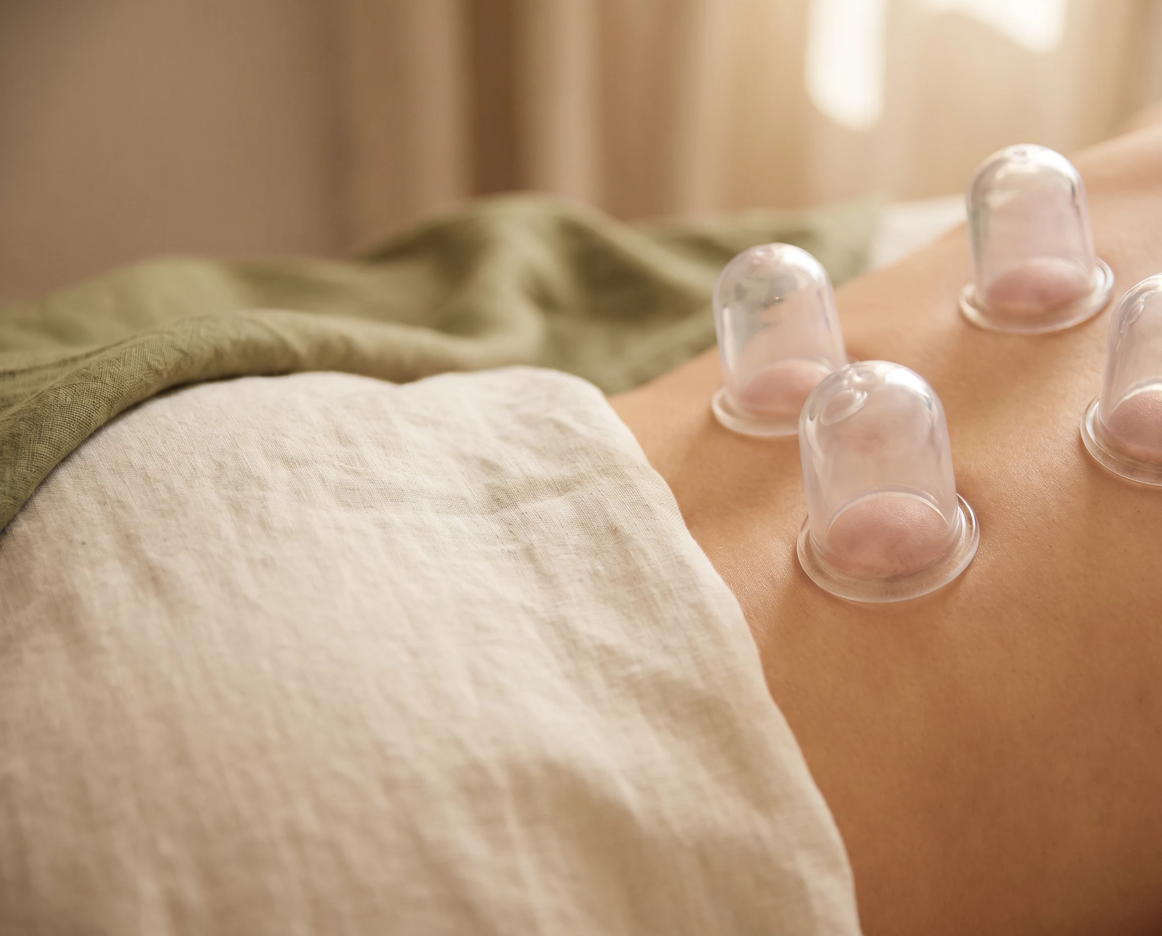 Clear silicone cups placed on an anonymous upper-back treatment detail against warm linen.