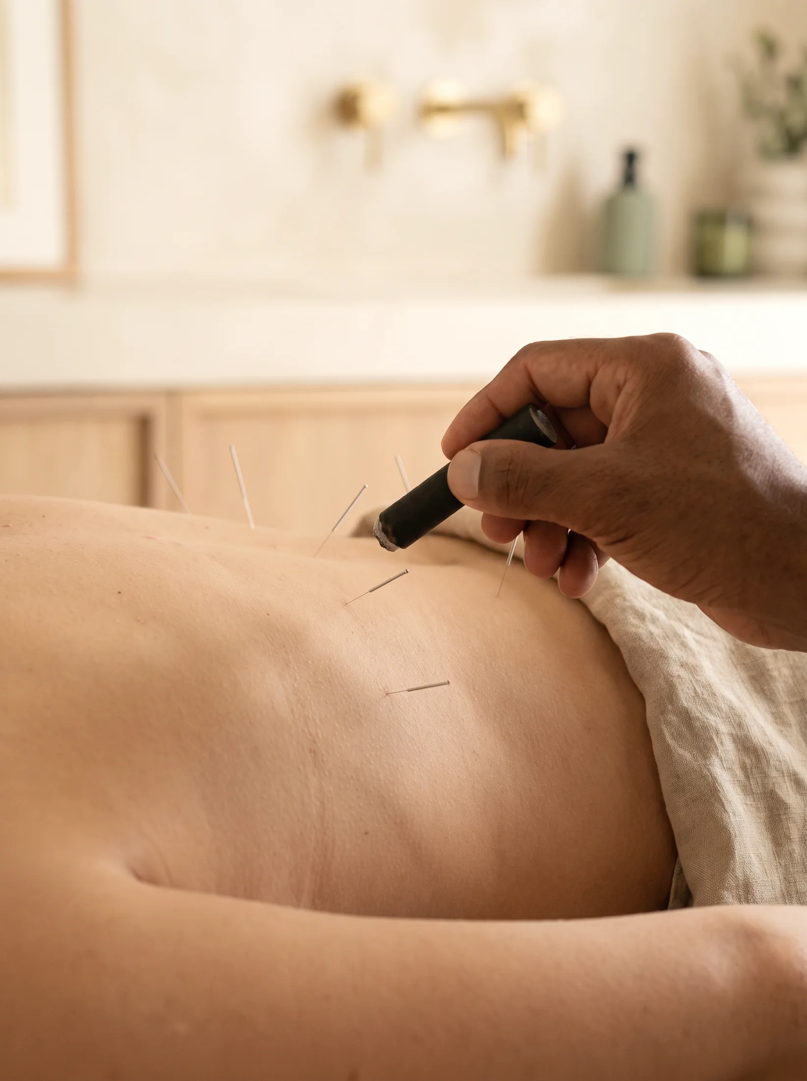 Moxibustion applied to a patient's back during treatment